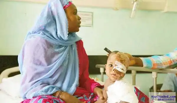 Graphic Photo:‘Boko Haram Set Our Daughter On Fire’- 14-Month-Old Baby